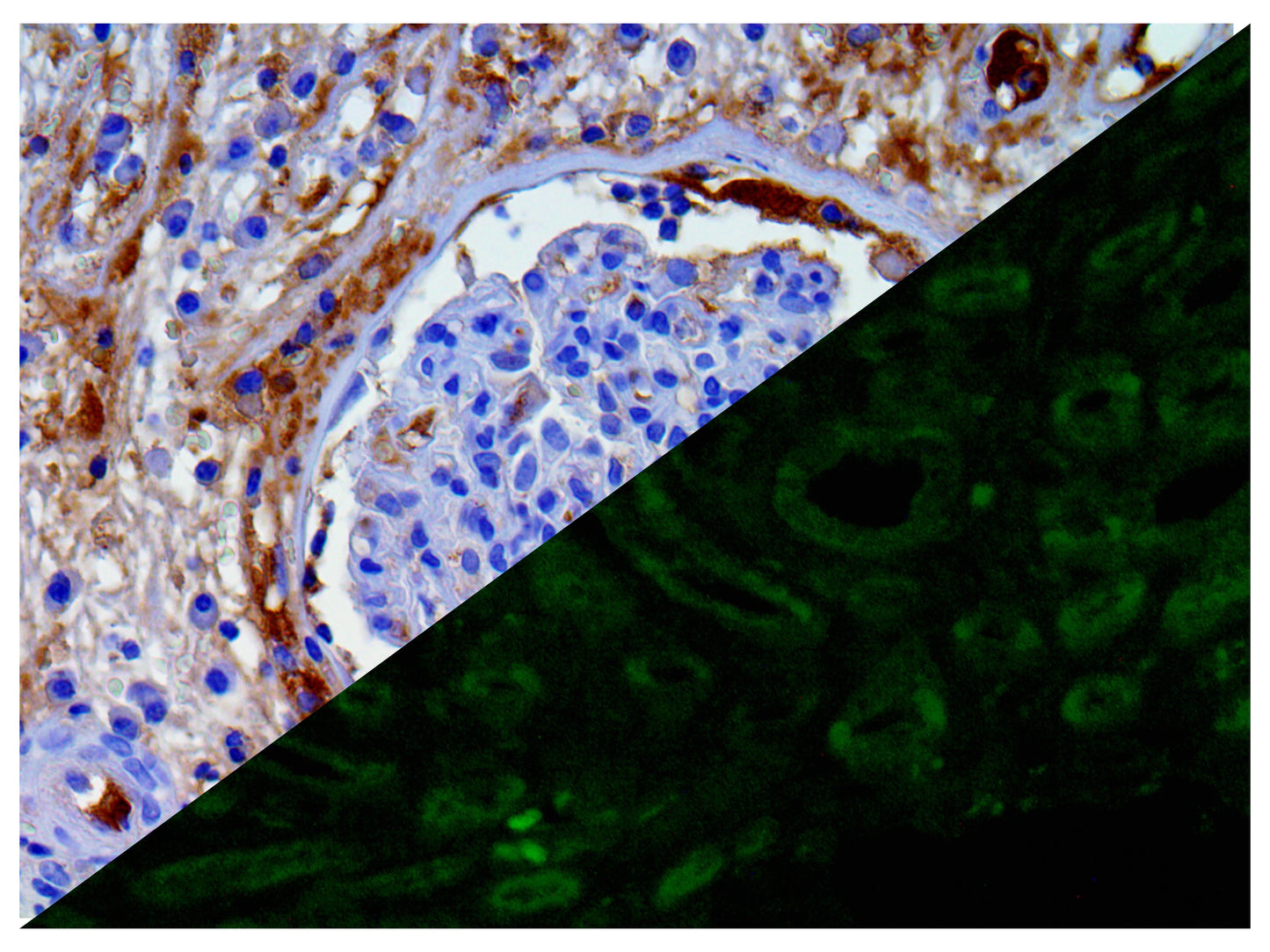 Amyloid A