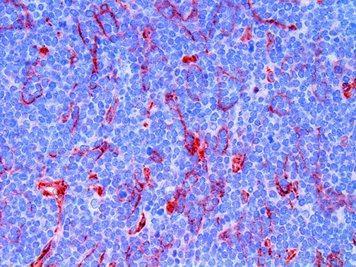 B7H3/CD276
