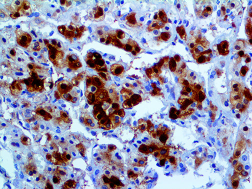 Glutamine Synthetase