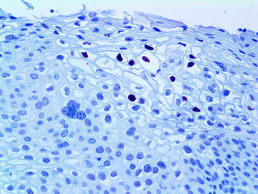 HPV16