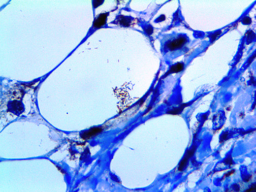 Mycobacterium tuberculosis