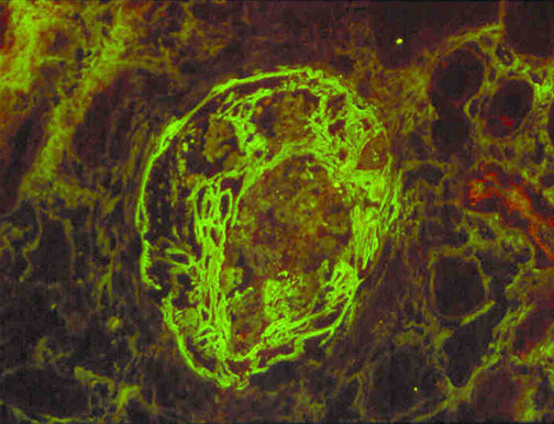 Fibrinogen\FITC
