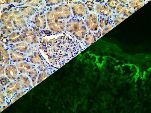 Fibrinogen