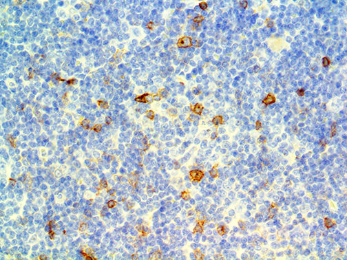 OX-40\CD134