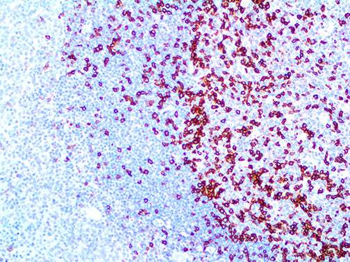PD-1/CD279
