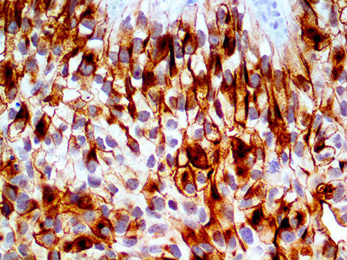Uroplakin III