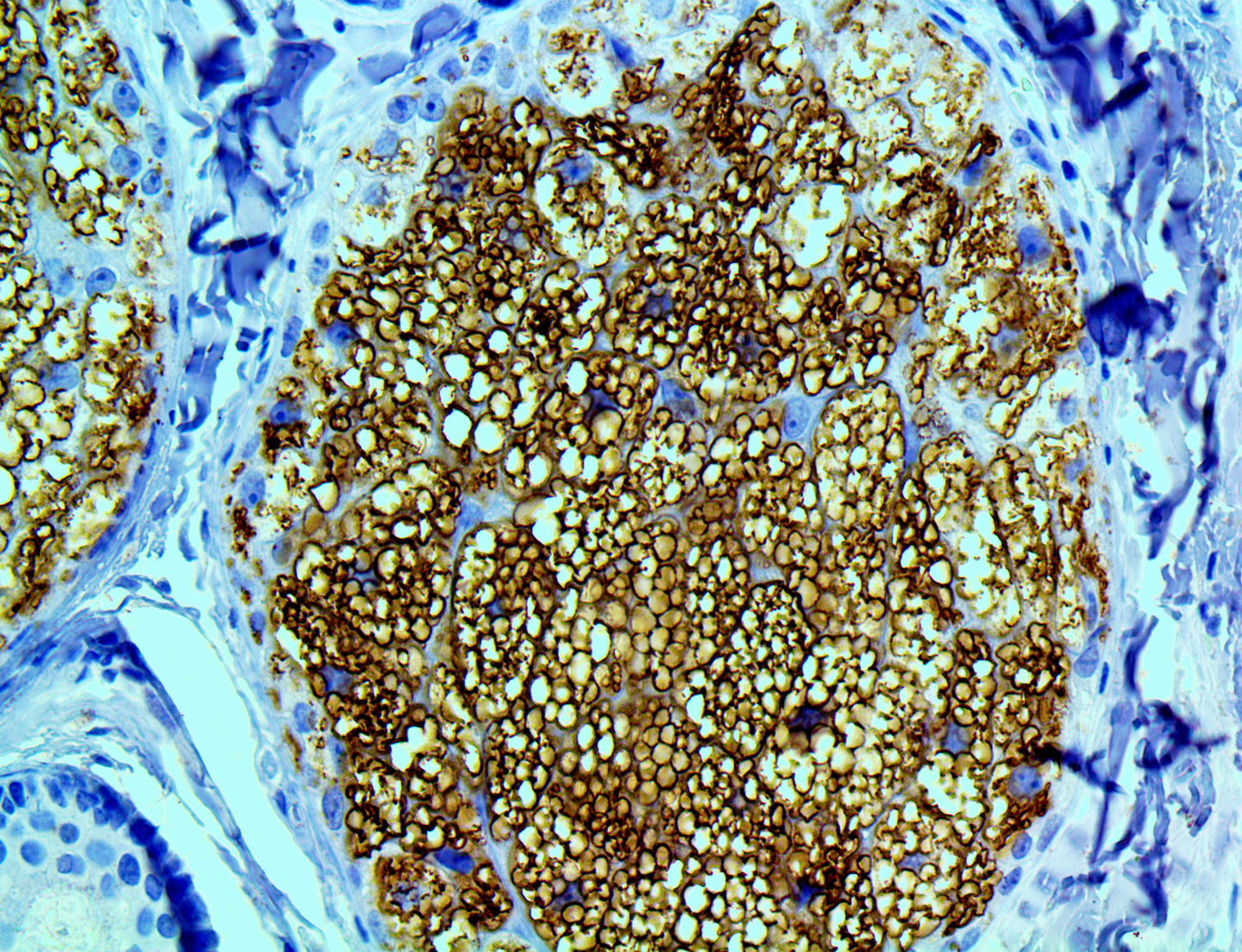 Adipophilin/ADRP