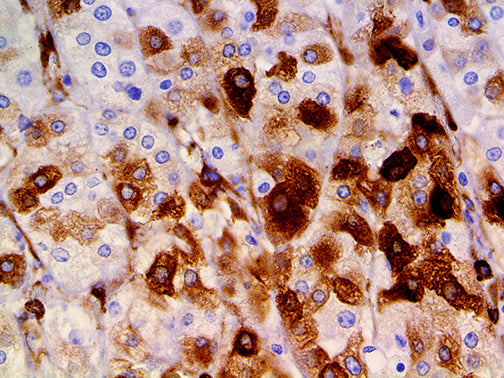 Osteonectin/SPARC