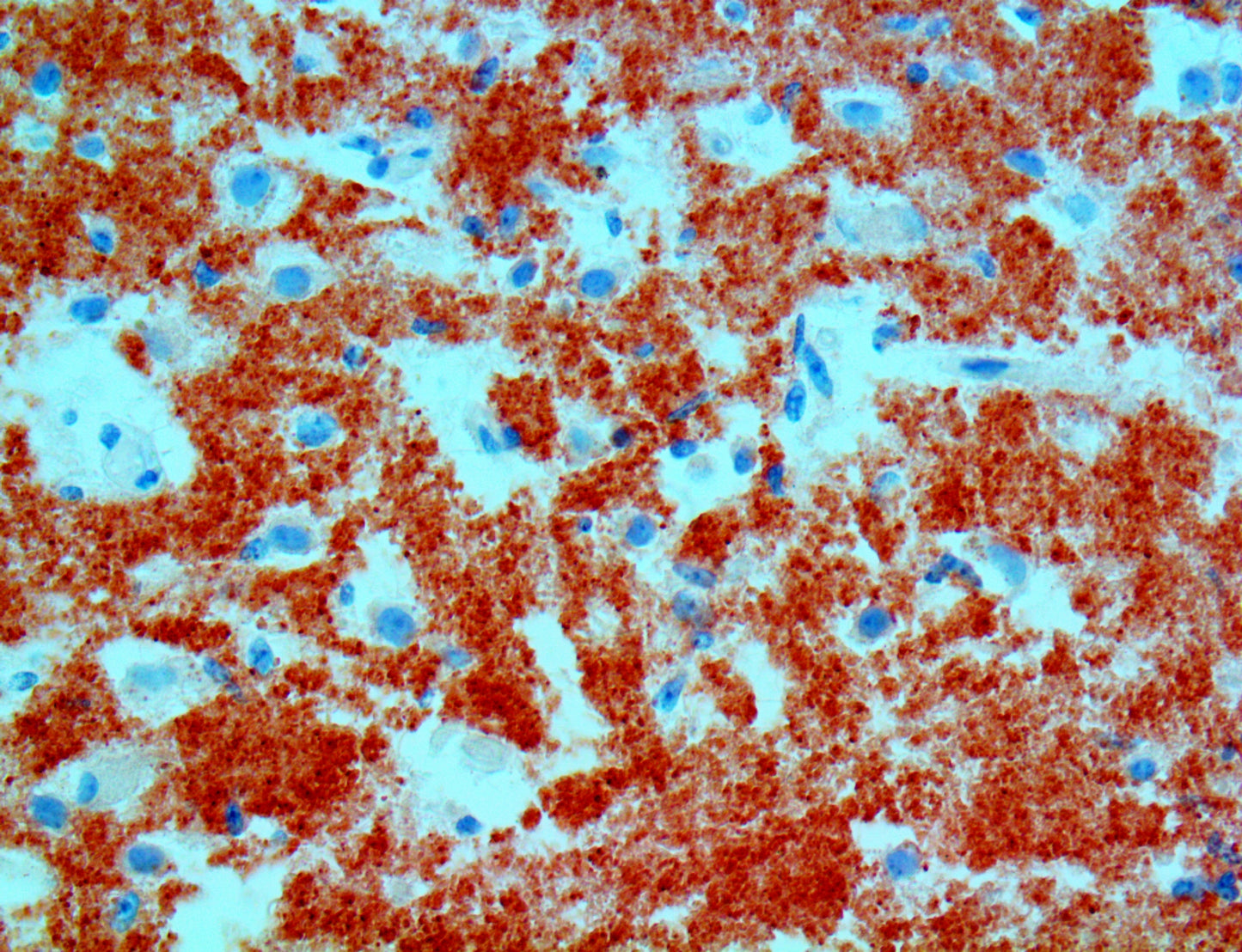 Alpha Synuclein