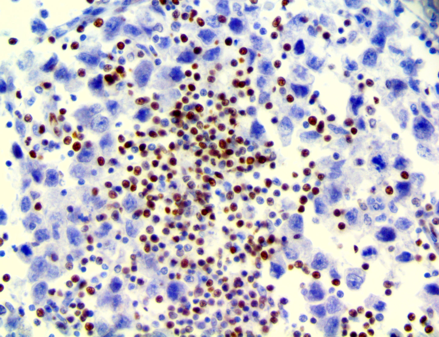 LEF-1