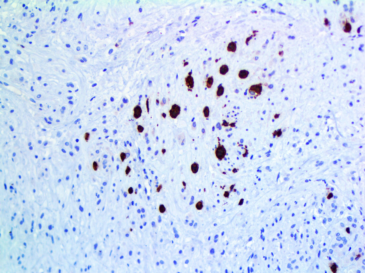 Myoglobin