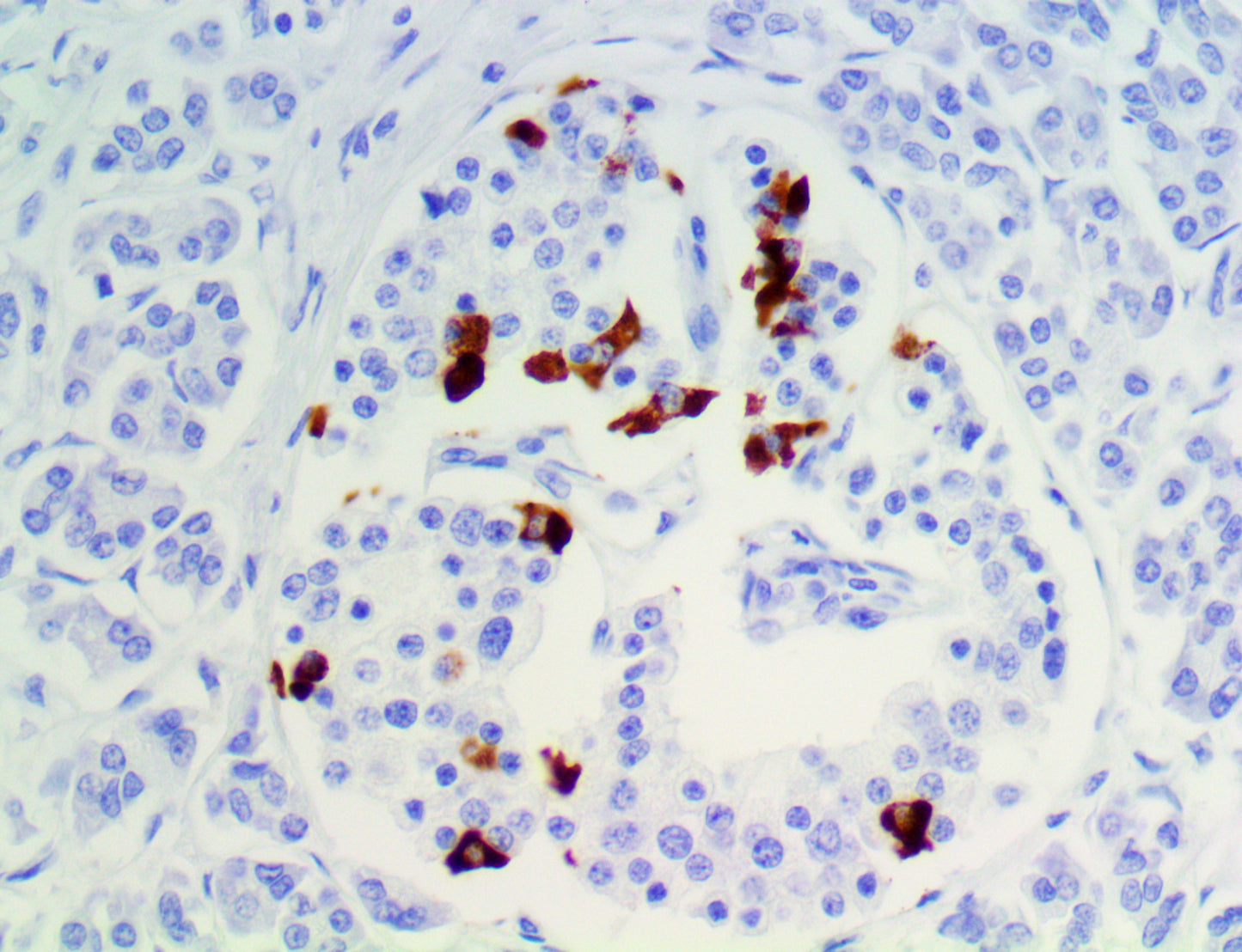 Somatostatin