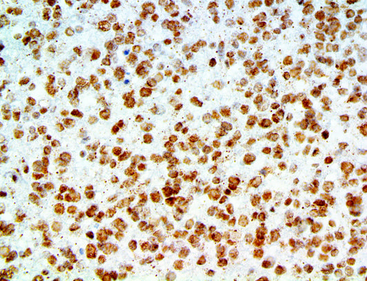 Amyloid Beta
