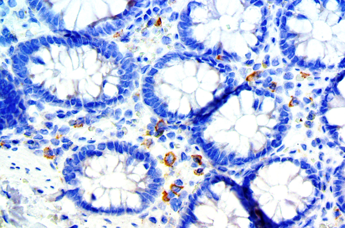 CD33