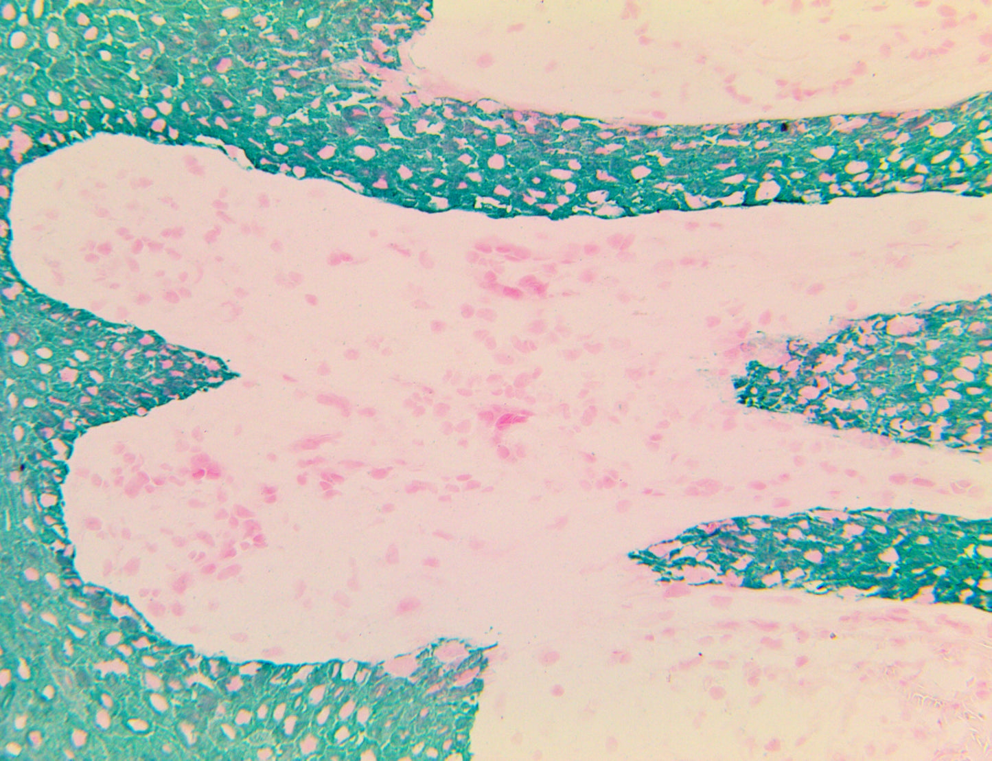 Cytokeratin MNF116