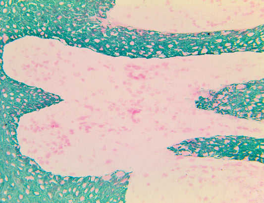 Cytokeratin MNF116