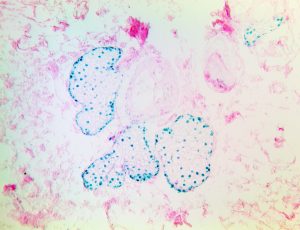 TintoFast Androgen Receptor