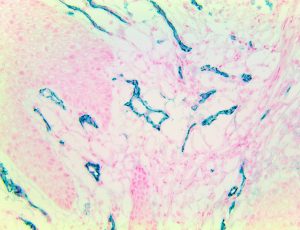 TintoFast CD31