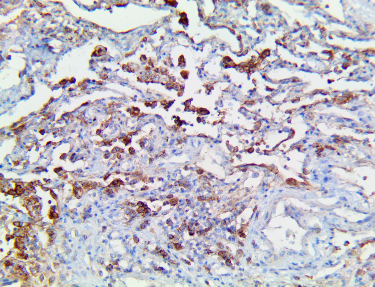CD147