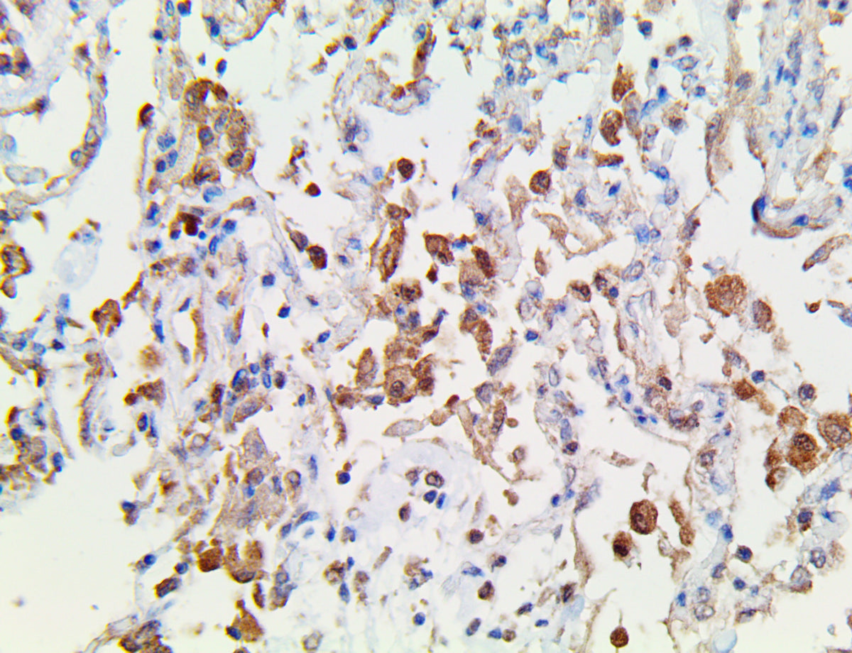 TNFa-IP2