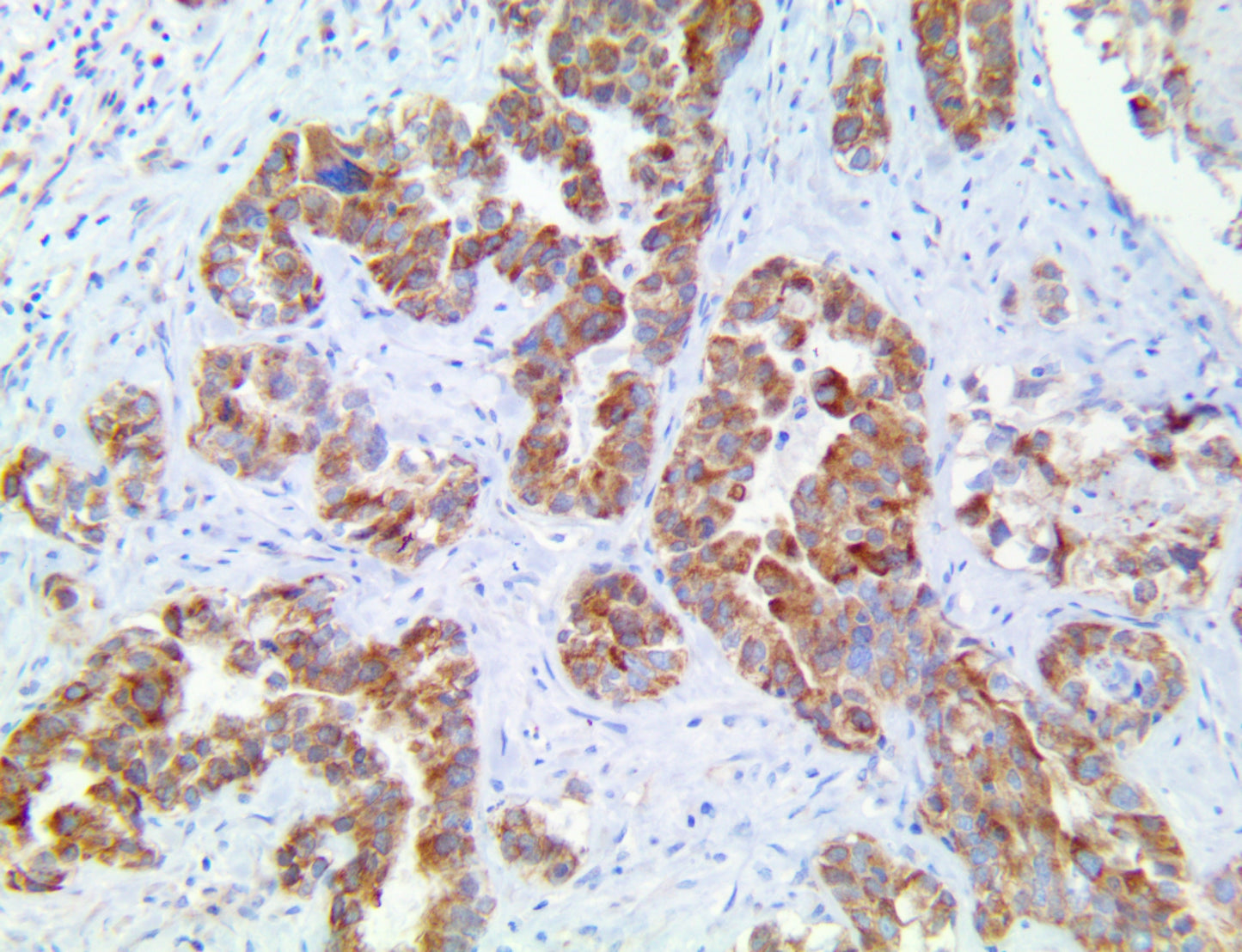 CXCR5/CD185