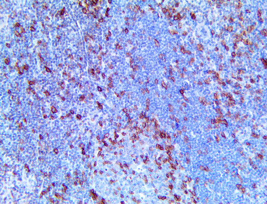 ICOS/CD278