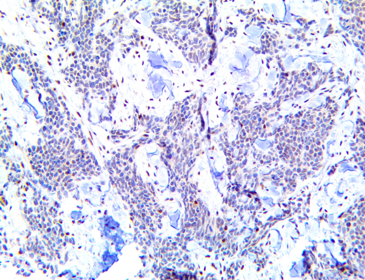 Pygopus 2/Pygo 2