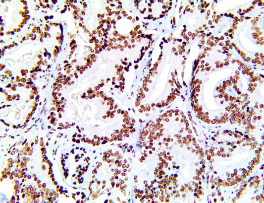 SF-1/Steroidogenic Factor 1