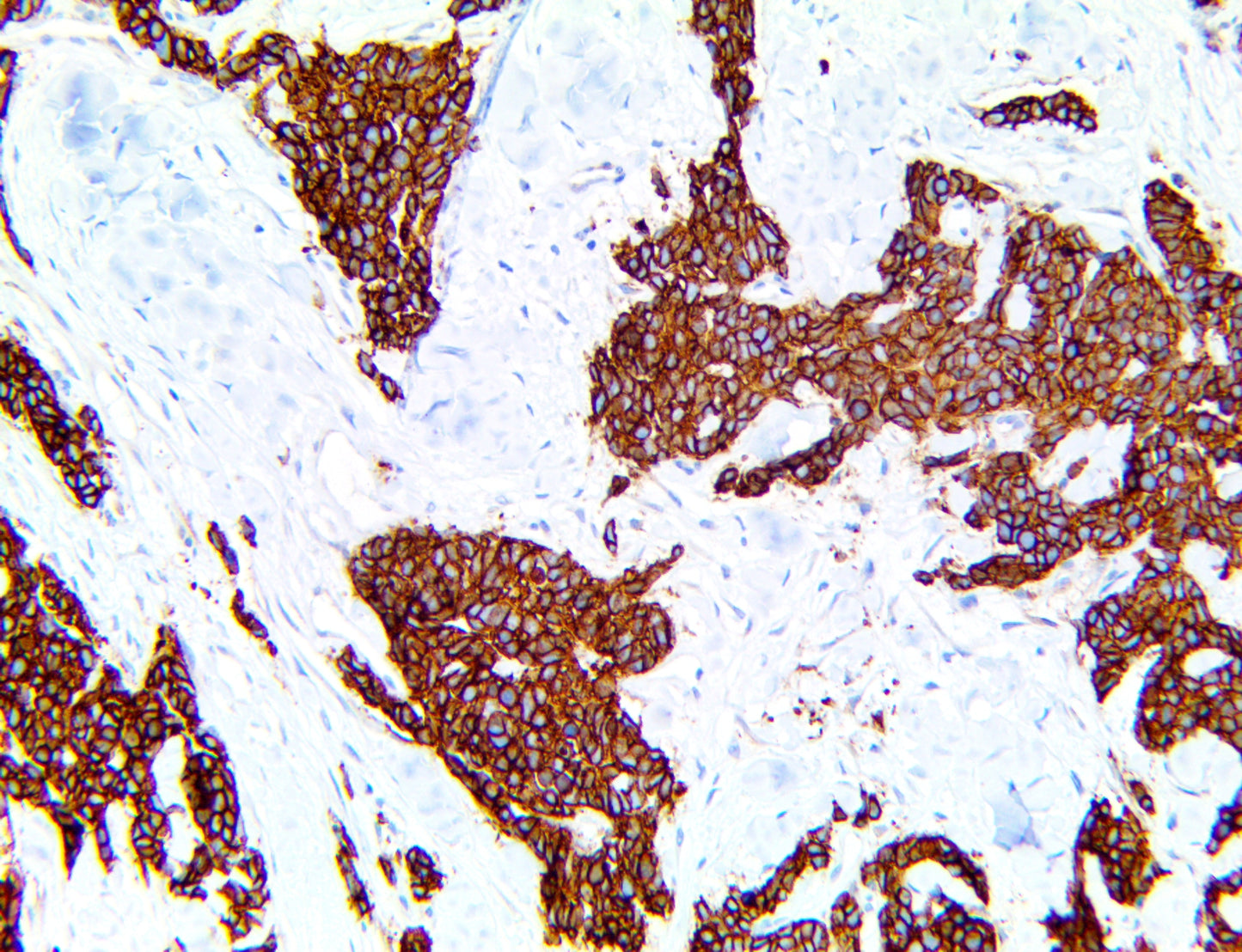 Somatostatin Receptor 2/SSTR2