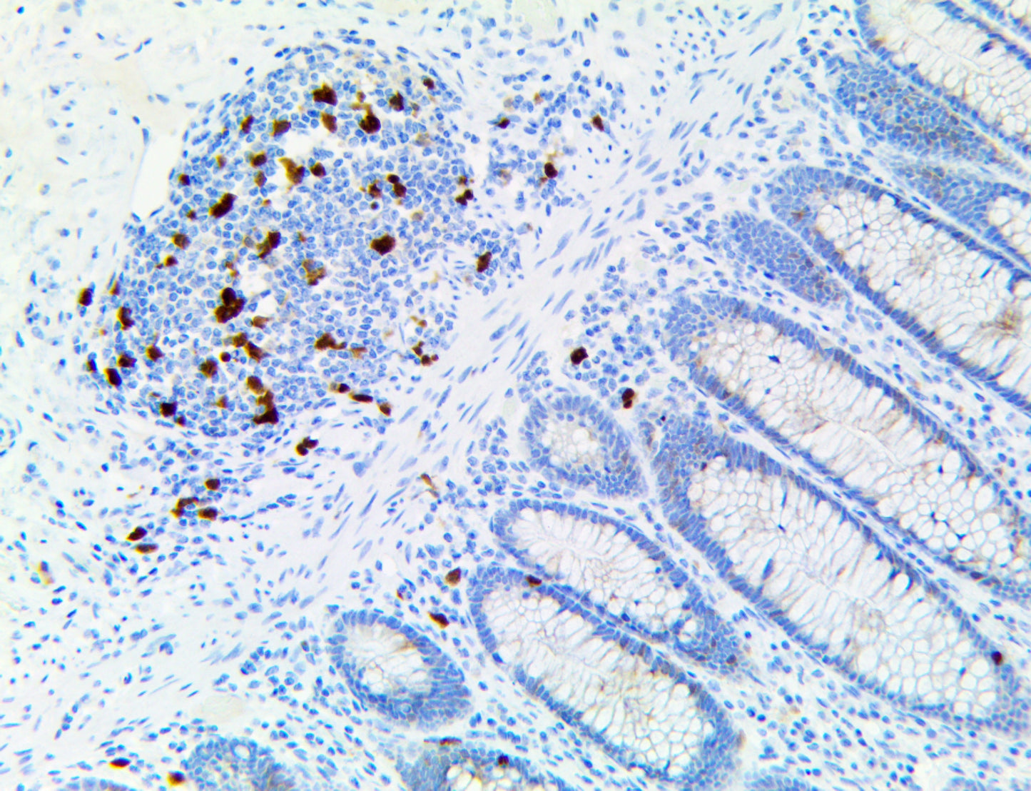 Thymidylate synthase/TS