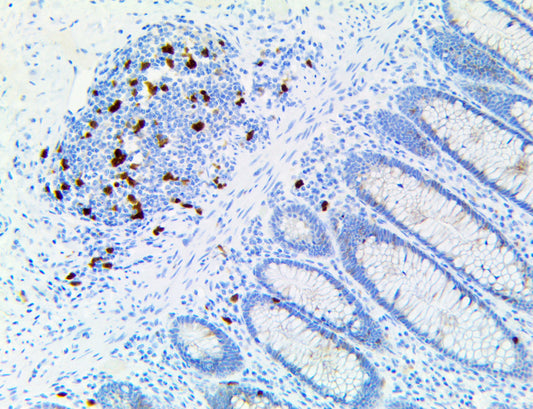Thymidylate synthase/TS
