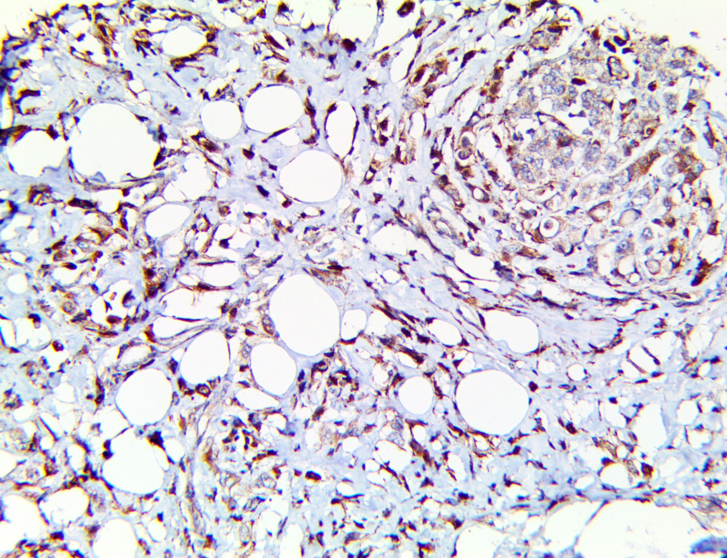 TIM-3/HAVCR2/CD366