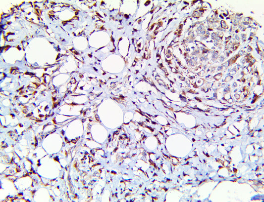 TIM-3/HAVCR2/CD366
