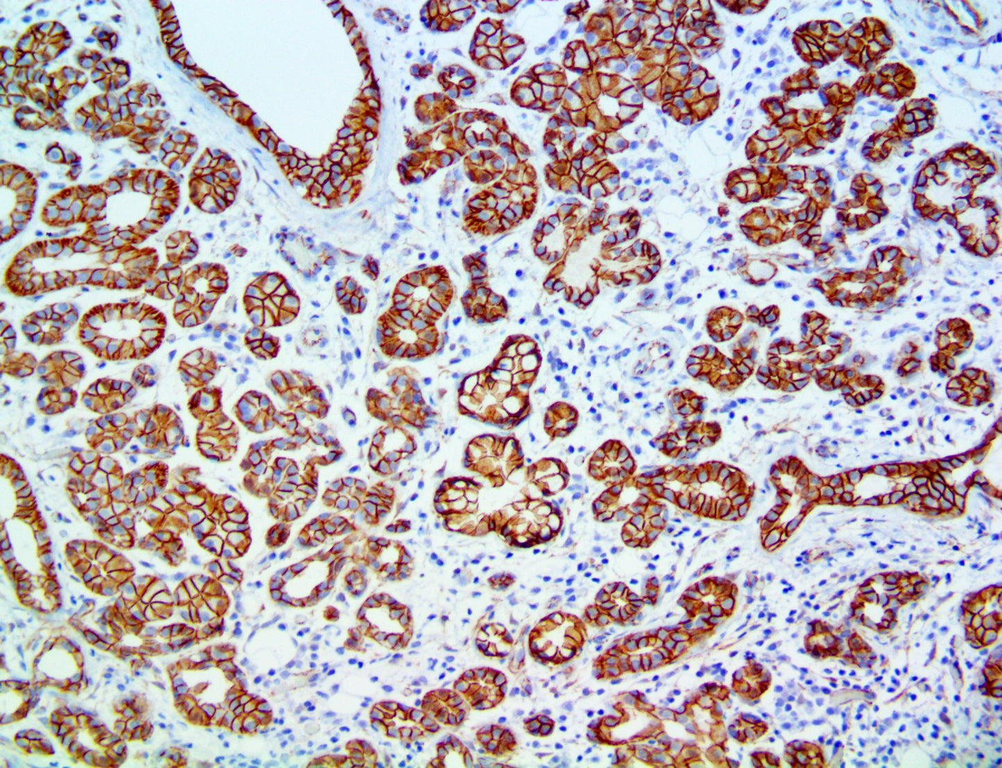 Beta-Catenin