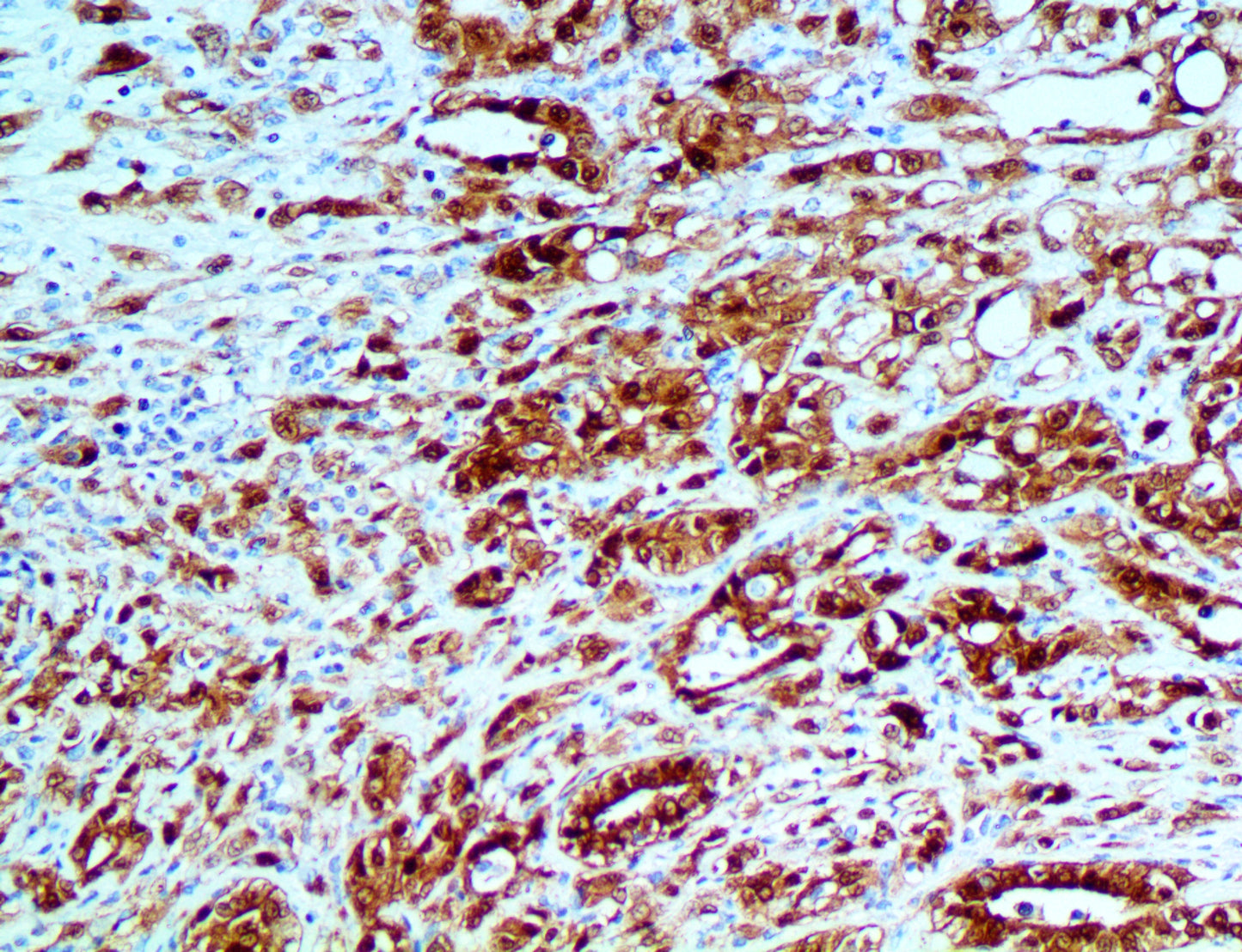 Calretinin