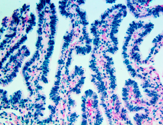 Estrogen Receptor