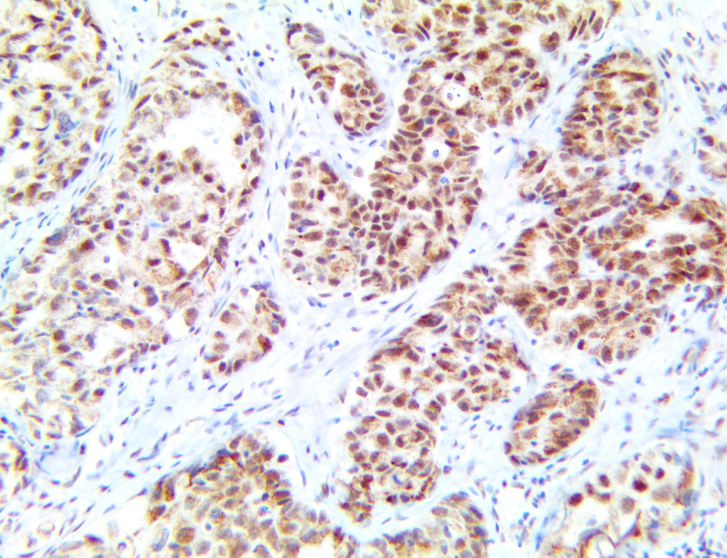 TDP-43/TARDBP