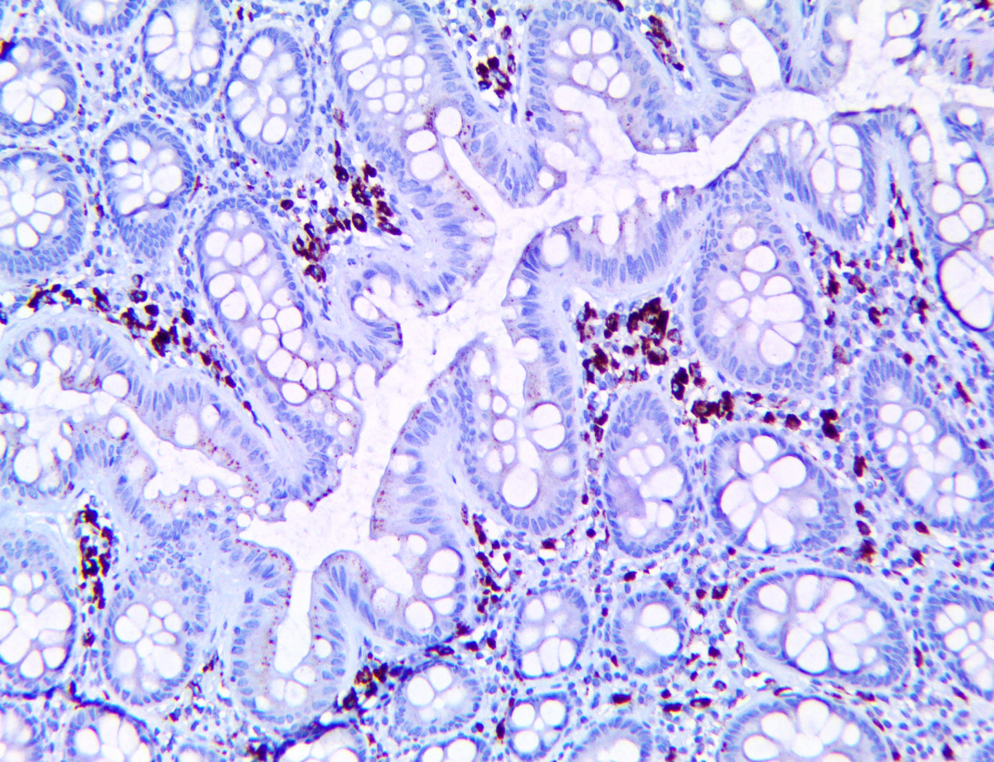 Cathepsin K