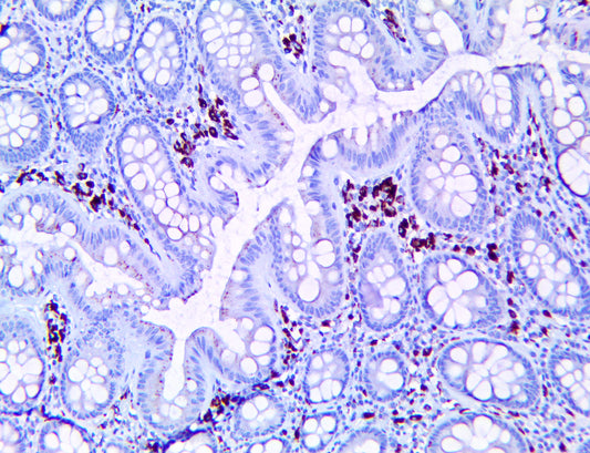 Cathepsin K