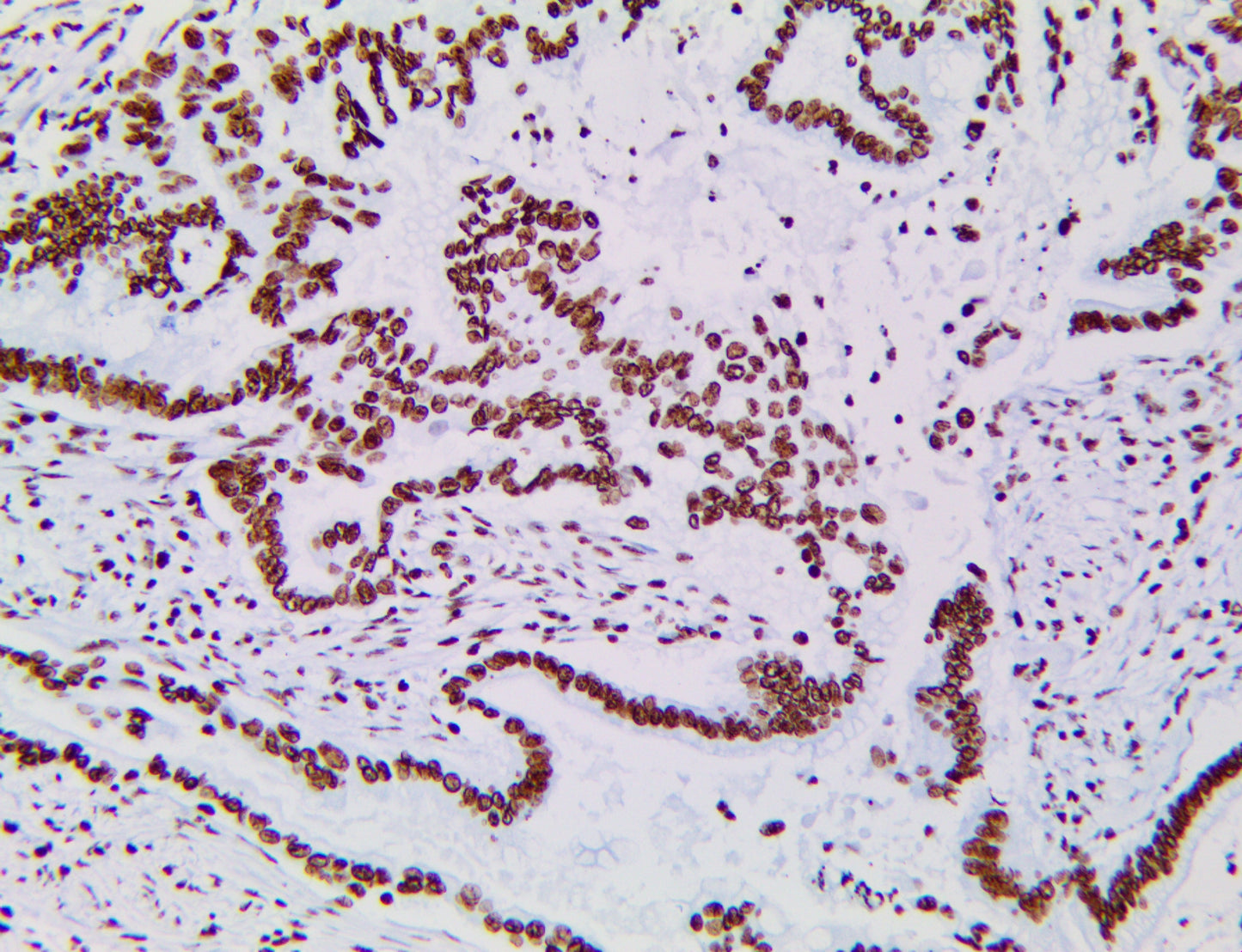 Tri-Methyl-Histone H3(Lys27)/H3K27Me3
