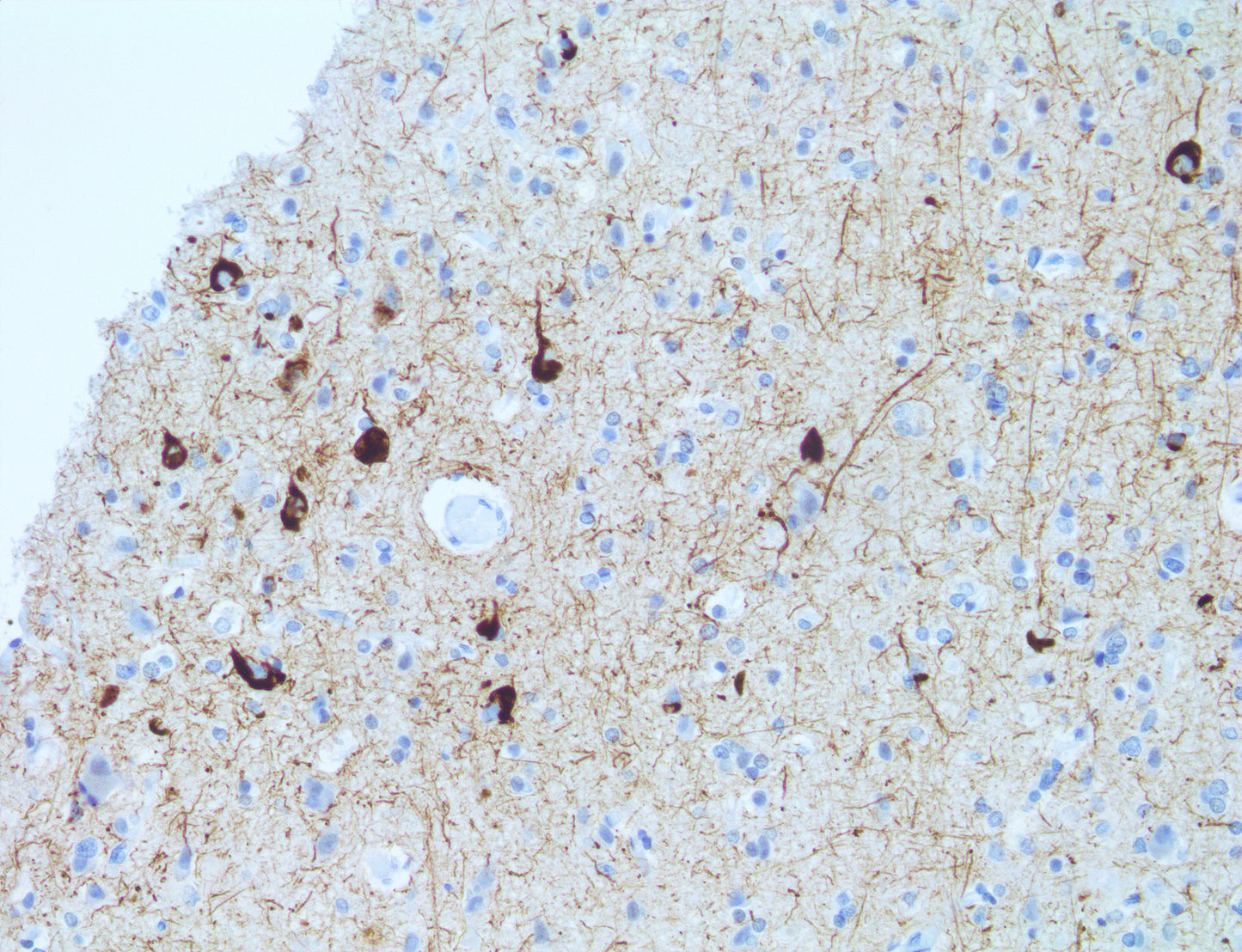pTau Phospho\Thr 181