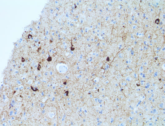 pTau Phospho\Thr 181