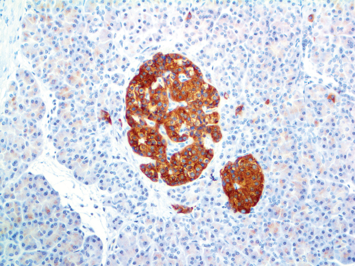 Synaptophysin
