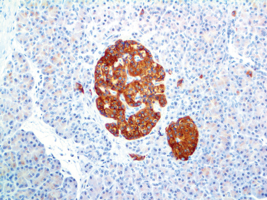 Synaptophysin