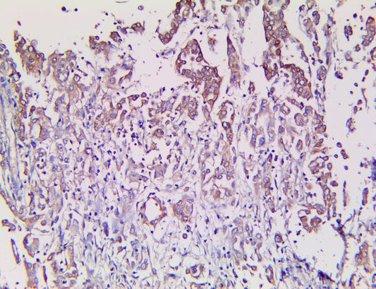 Calretinin