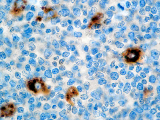 A-1-Antitrypsin