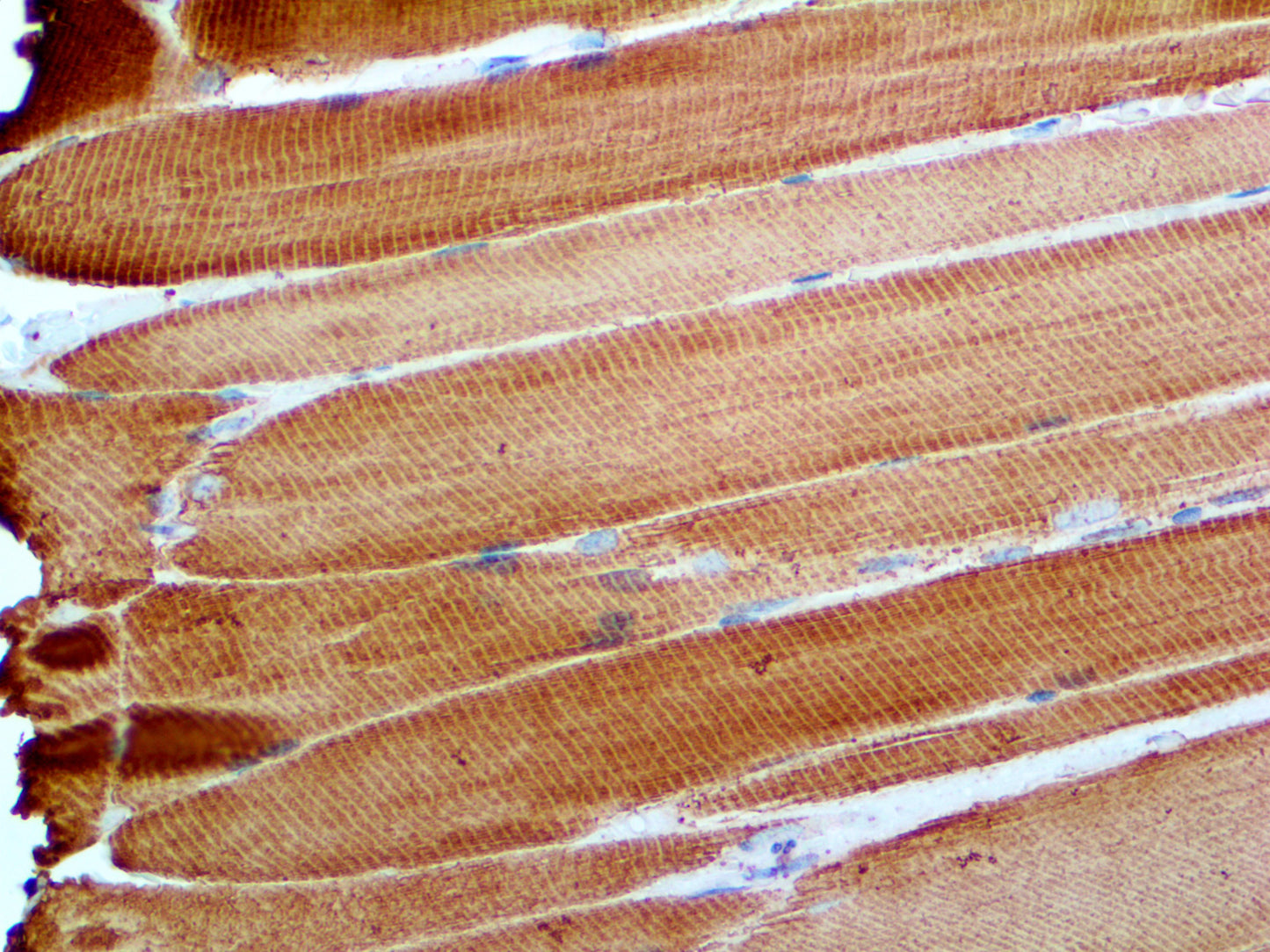 Actin Muscle Specific
