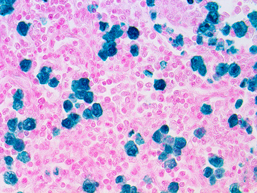 ALK-1\CD246