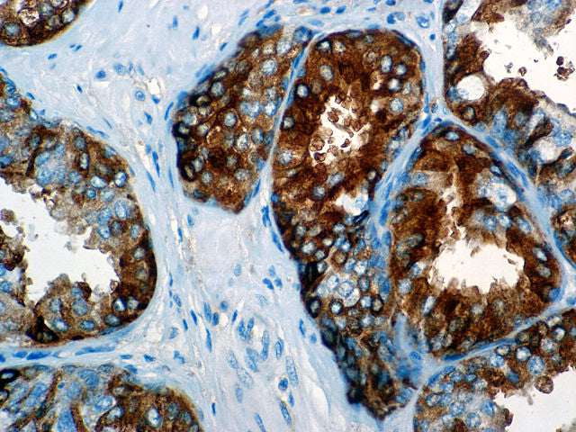 Alpha-Fetoprotein
