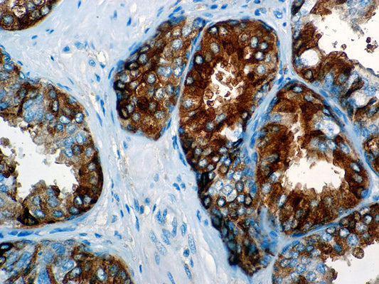 Alpha-Fetoprotein